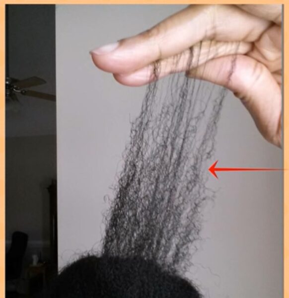 Ultimate Cures To Get Over Hair Breakage At The Crown Area And Its Causes