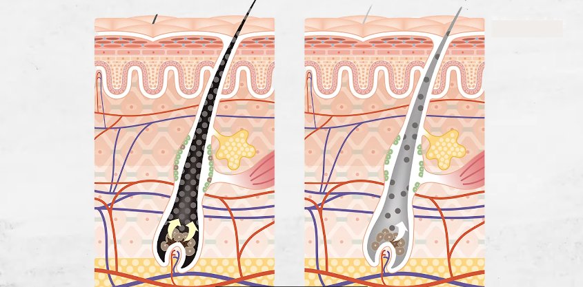 Understanding Hair Pigmentation